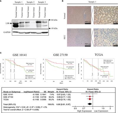 Lipolysis-Stimulated Lipoprotein Receptor Impairs Hepatocellular Carcinoma and Inhibits the Oncogenic Activity of YAP1 via PPPY Motif